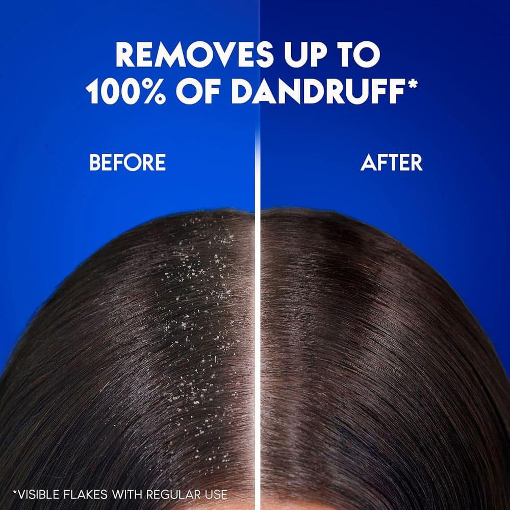 Head & Shoulders Classic Clean Anti-Dandruff Shampoo 1000ml