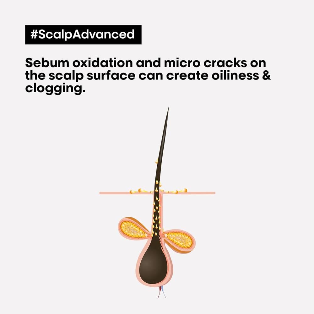L'Oréal Professionnel Scalp Advanced Anti-Greasy Shampoo - 300 ml