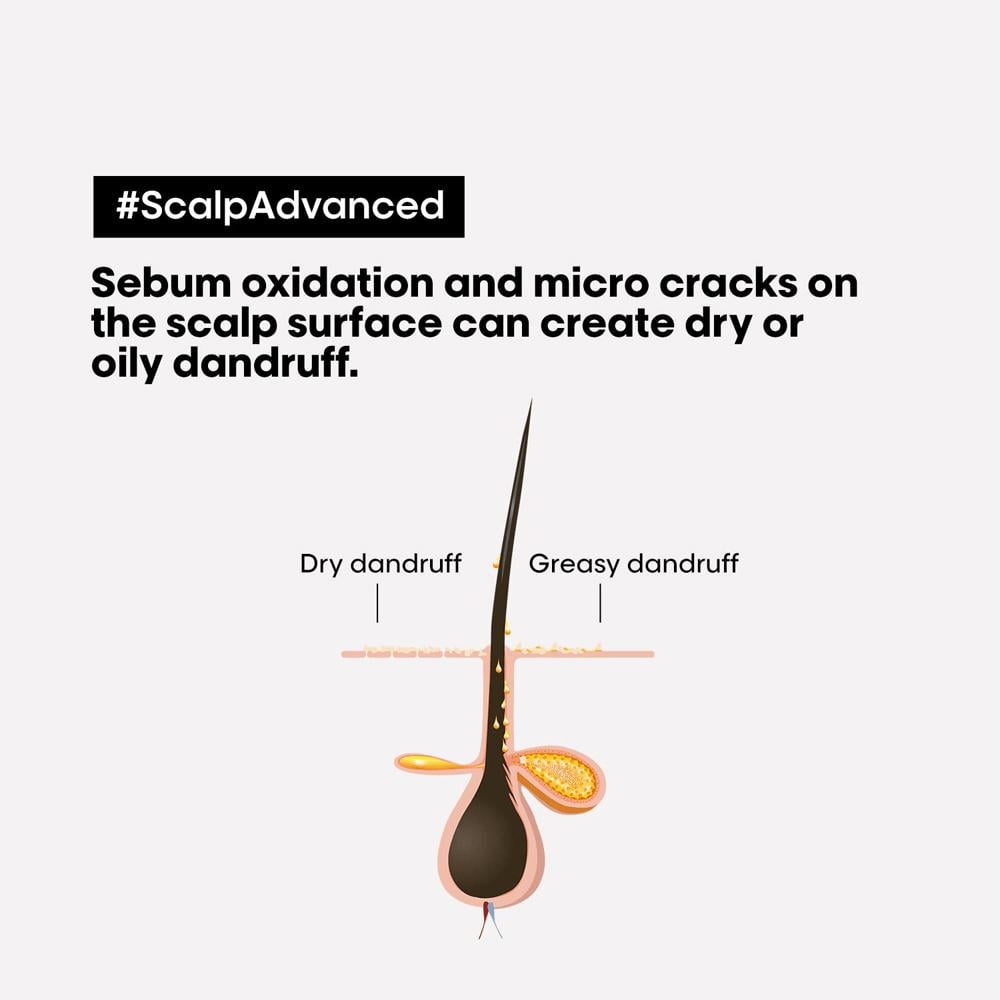 L'Oréal Professionnel Scalp Advanced Anti-Dandruff Shampoo - 300 ml