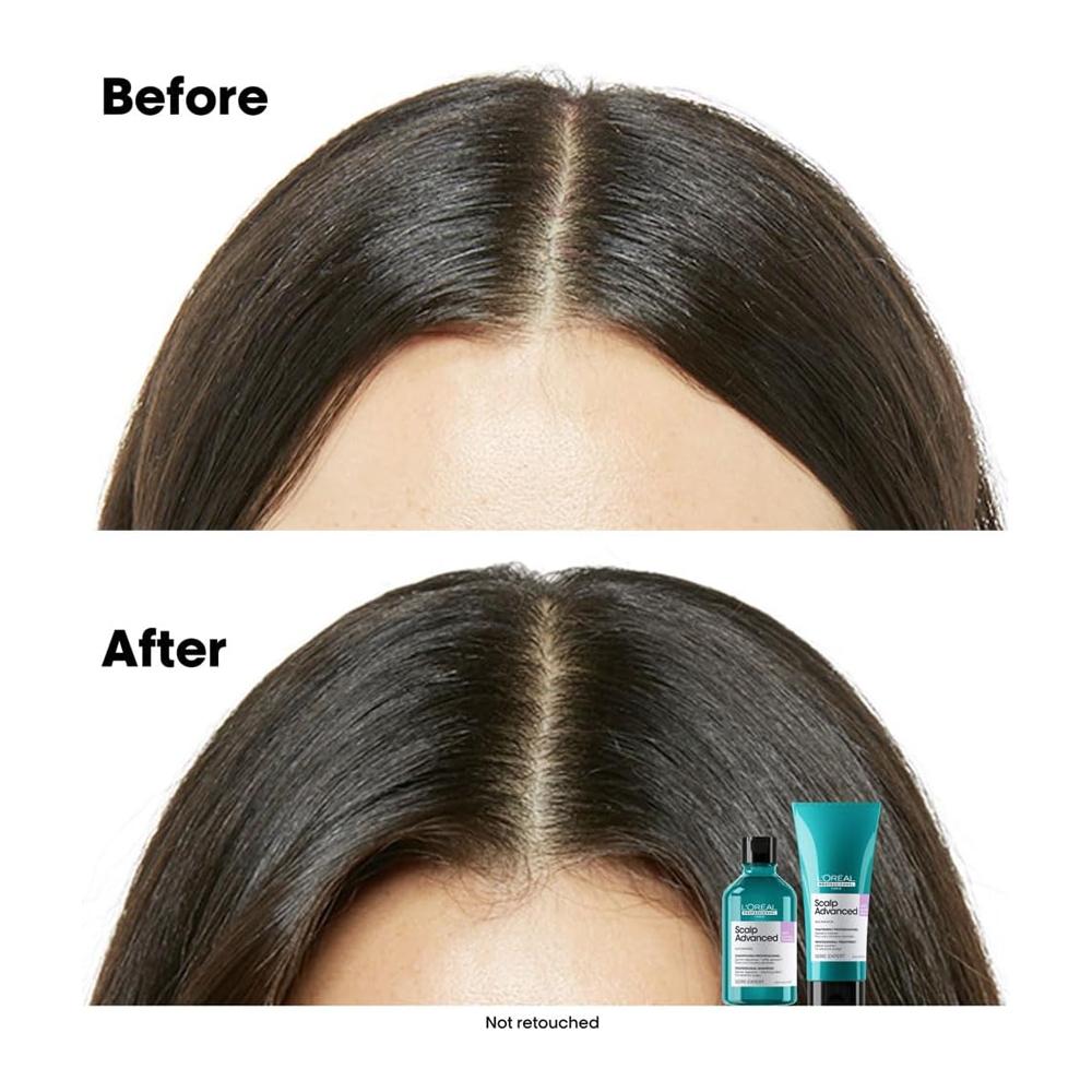 L'Oréal Professionnel Scalp Advanced Anti-Discomfort Shampoo - 300 ml