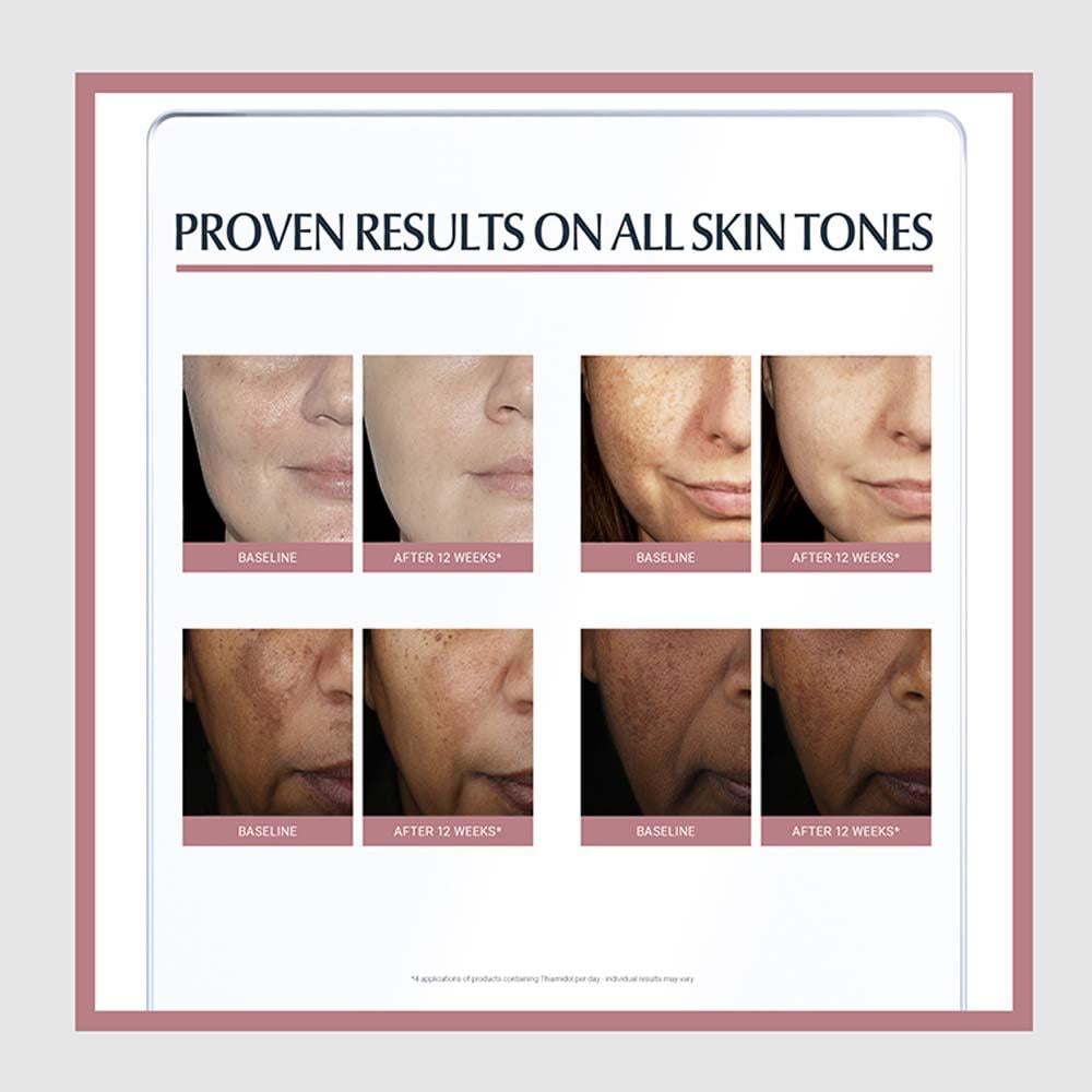 Eucerin Even Pigment Perfector Dual Serum - 30 ml