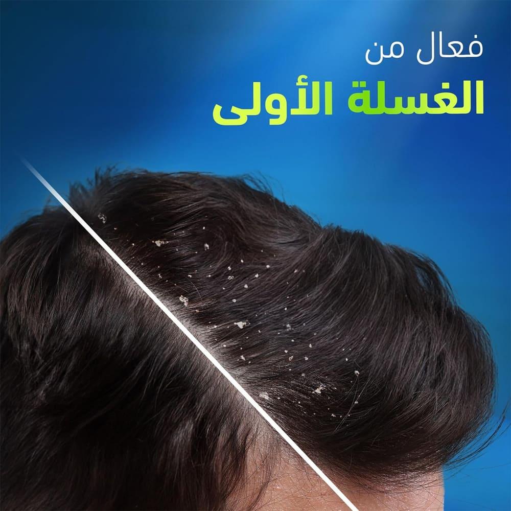 Head & Shoulders Anti-Dandruff Shampoo for Very Oily Scalp - 400ml