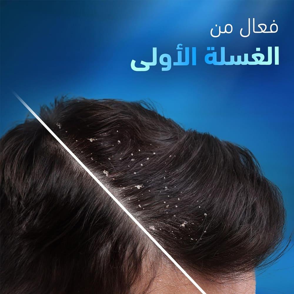 Head & Shoulders Anti-Dandruff Shampoo for Severely Dandruffy Scalp - 400ml