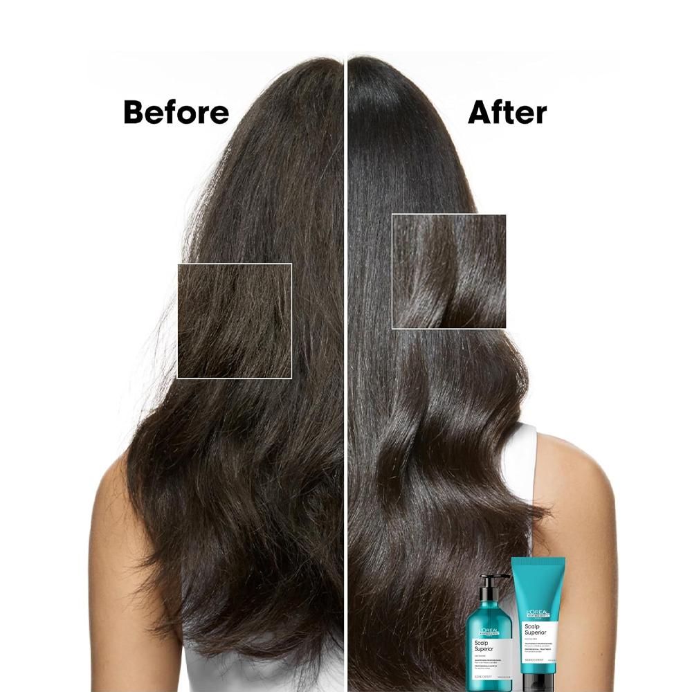 L'Oréal Professionnel Scalp Advanced Anti-Greasy Shampoo - 500 ml
